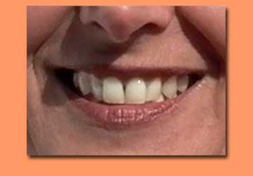 bild_lachen