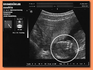 embryo